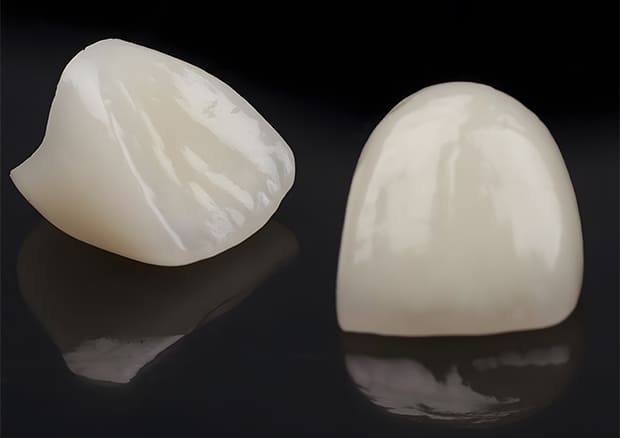 セラミック治療のメリット