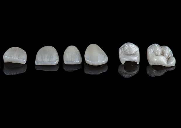 当院のセラミック治療の特徴