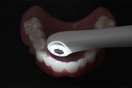 ワイヤレス口腔内カメラ