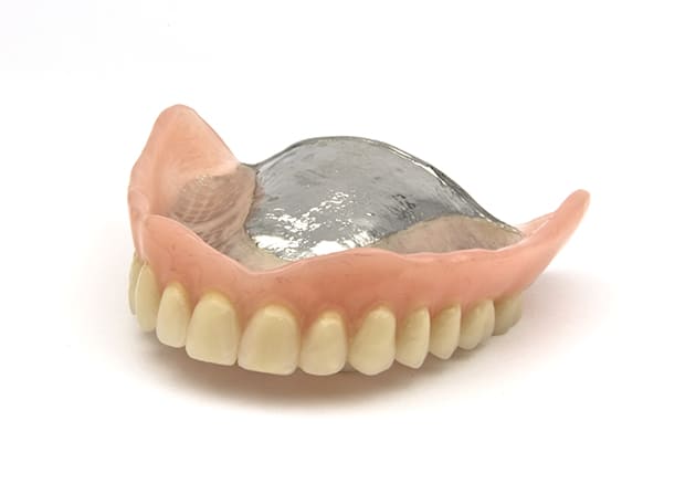 金属床義歯