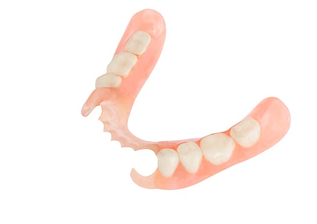 ノンクラスプデンチャー