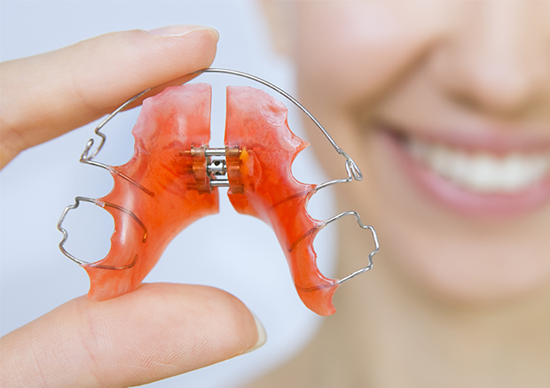 子供の矯正のタイミング