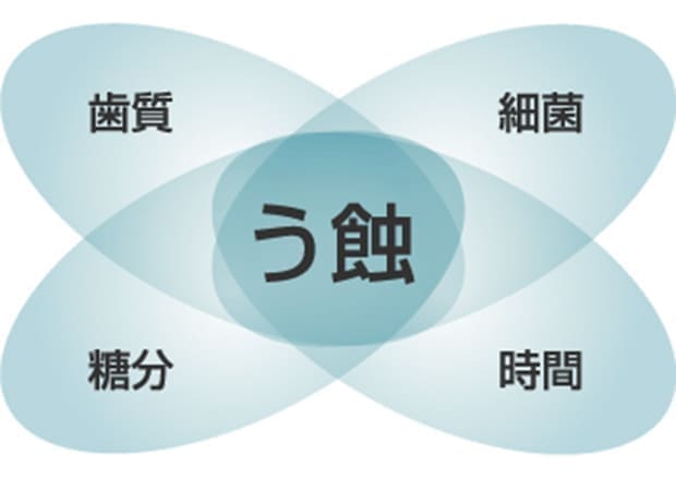 虫歯の予防について