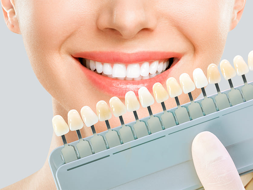 輝く笑顔を手に入れるホワイトニング